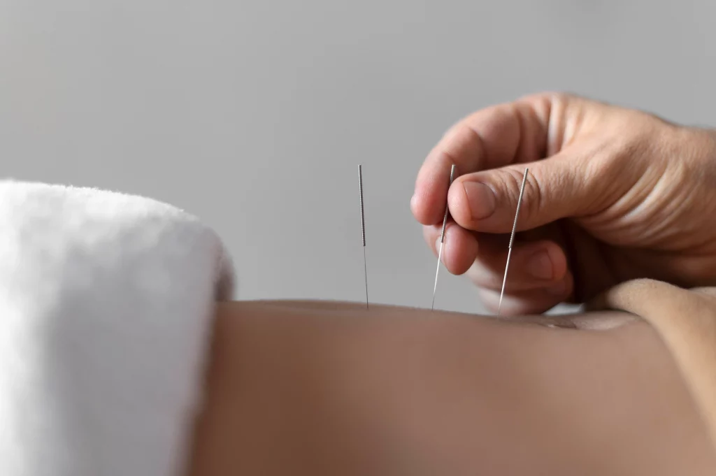Akupunktur ve Fizik Tedavi